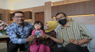 Gubernur Bantu Balita Pengidap Apert Syndrome