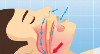 Tips Atasi Ngorok, Suara Mendengkur  Saat Tidur